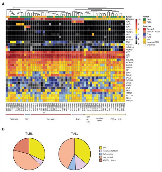 Subtypes associated to developmental stages in T-LBL and T-ALL. (A) Unsupervised clustering of T-LBL and T-ALL based on genes associated with the T-cell developmental genes, showing clustering in the major T-ALL subtypes for most of the T-LBL samples. Range of 0 to 10 showing the log2 transcript per millions of normalized expression values. (B) Distribution of subtypes associated with T-cell developmental stages in T-LBL and T-ALL shows great similarities, suggesting similar stages of arrest in T-LBL and T-ALL.