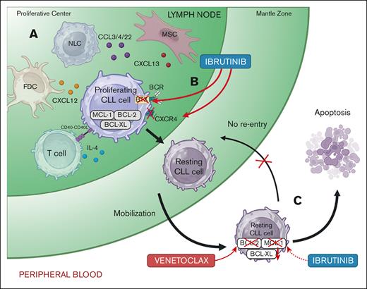 The effects of ibrutinib and venetoclax on CLL cells in different microenvironments. (A) The lymph node provides a favorable microenvironment for CLL cells in which they receive survival signals from various stromal cells and immune cells via cell-cell interactions and soluble factors. BCL-2 family proteins, such as MCL-1 and BCL-XL, are upregulated, conferring resistance to venetoclax. (B) Ibrutinib covalently binds and inactivates BTK, leading to inhibition of BCR signaling. In addition, ibrutinib reduces chemokine receptor CXCR4, causing CLL cells to be released in the PB and impeding their homing back to the lymph nodes. (C) In the PB, recently emigrated CLL cells lose the supportive microenvironment, have reduced BCL-XL expression, and become dependent on BCL-2 signaling. Venetoclax directly targets BCL-2 (red arrow), whereas ibrutinib indirectly inhibits MCL-1 prosurvival protein (red dashed arrow), causing apoptosis of CLL cells. CCL3/4/22, C-C motif chemokine ligands 3, 4, and 22; CXCL12/13, chemokine C-X-C motif ligands 12 and 13; CXCR4, C-X-C chemokine receptor type; FDC, follicular dendric cell; MSC, mesenchymal stem cell; NLC, nurse-like cell. Figure created with BioRender.com.