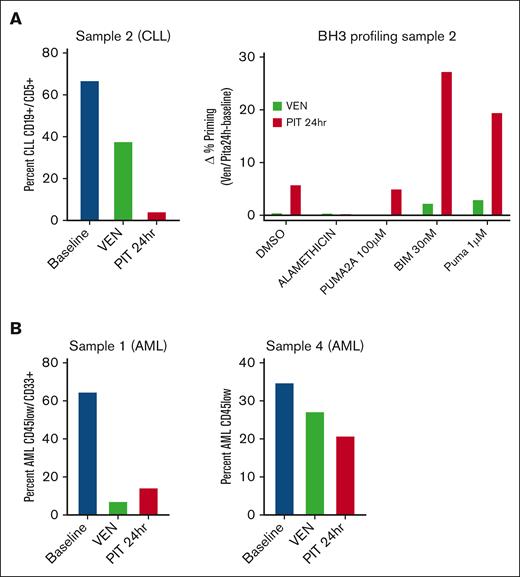 Correlative studies suggest that pitavastatin reduces leukemia burden after a single dose in some patients. (A) Analysis of PBMCs from a patient with CLL. Left: the percentage of leukemia cells was determined by flow cytometry before treatment (baseline), after VEN ramp-up (VEN), and 24 hours after the first PIT dose (PIT 24 hours). Right: BH3 profiling was performed on gated CLL blasts by measuring cytochrome C release after exposure to DMSO alone, alamethicin (positive control apoptotic stimulus), PUMA2A (negative control peptide), or active BIM or PUMA peptides. The change in the percentage of cytochrome C–low cells between the VEN or PIT conditions and baseline was graphed as delta percentage priming. (B) Analysis of PBMCs from 2 patients with AML. The percentage of AML blasts was determined using flow cytometry. Each experiment in panels A and B was done with a single sample, without technical replicates. DMSO, dimethyl sulfoxide; PUMA, p53 upregulated modulator of apoptosis; BIM, BCL2 interacting mediator of cell dealth.
