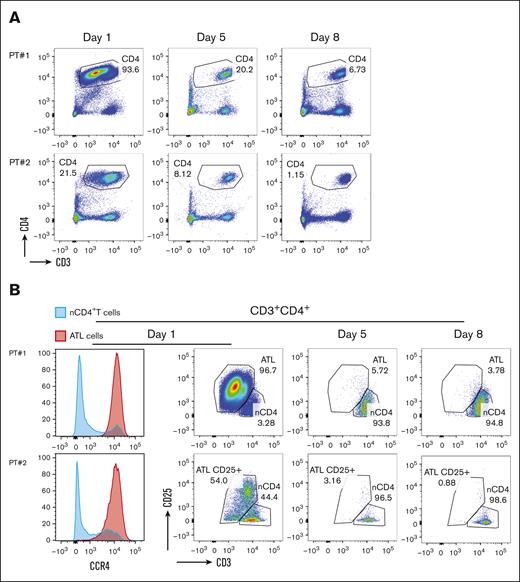 Changes in circulating T and lymphoma cells. CD4+ T cells in peripheral blood are decreased after initiation of cycle 1 rhIL-15 and mogamulizumab (A) with preferential depletion of CD4+ T cells with a phenotype consistent with ATLL (B).