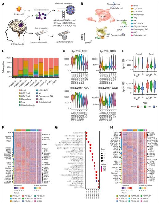 Landscape of single-cell analysis and interpatient heterogeneity in PCNSL. (A) Schematic of the workflow for single-cell sequencing, spatial transcriptomics, and IHC analyses. (B) Uniform manifold approximation and projection (UMAP) plot of all cells after the integration assay colored according to the cell type. (C) Bar chart shows the proportion of each cell type split by samples. (D) Violin plot of GCB and ABC signature scores based on 2 different gene lists (Scott et al16 and Reddy et al17). (E) Violin plot shows the distribution of the GCB signature score between tumor and reactive samples. (F) Heat map of the top differentially upregulated genes in each sample. (G) Dot plot shows representative biological pathways enriched in each patient using Gene Ontology Biological Process. (H) Heat map of the top differentially downregulated genes in each sample. DC, dendric cell; NK, natural killer cell; Treg, regulatory T cell.