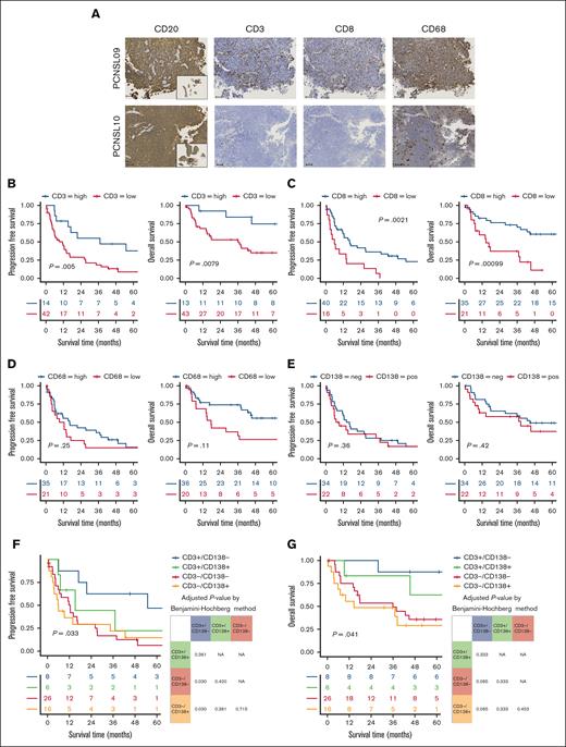 Low T-cell infiltration PBL signature PCNSL shows unfavorable prognosis. (A) Representative IHC images of 2 samples show tumor cells diffusely positive for CD20 and the variations in the infiltration of CD3+, CD8+, and CD68+ cells. Small panel of CD20 staining shows an overall image of the tumor. Scale bar shows 100 μm. (B) Kaplan-Meier survival curves of PFS (left) and OS (right) for patients with high or low CD3+ infiltration. (C) Kaplan-Meier survival curves of PFS (left) and OS (right) for patients with high or low CD8+ infiltration. (D) Kaplan-Meier survival curves of PFS (left) and OS (right) for patients with high or low CD68+ infiltration. (E) Kaplan-Meier survival curves show no significant difference in PFS (left) or OS (right) between patients with or without CD13+ lymphoma cells. Kaplan-Meier survival curves for PFS (F) and OS (G) according to the presence of CD138+ cells and the degree of CD3+ cell infiltration. The tables show adjusted P value using the Benjamini-Hochberg method, with P values <.05 highlighted in red.