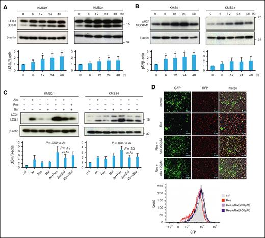 Flux and turnover assays for evaluating Abx-induced autophagic response in myeloma cells. (A) Change in LC3-II expression levels in myeloma cells by Abx treatment (flux assay). Western blots revealed time course increases in LC3-II expression in KMS21 and KMS34 cells after 100 μM Abx treatment. ∗P < .05 vs 0 hour. (B) Change in p62/SQSTM1 expression in myeloma cells by Abx treatment. Time course changes in p62/SQSTM expression were evaluated by western blots in KMS21 and KMS34 cells after treatment with 100 μM Abx. ∗P < .05 vs 0 hour. (C) Turnover assay of myeloma cells by Abx. KMS21 and KMS34 cells were exposed to 100 μM Abx for 24 hours and cotreated with 100 μM resveratrol (Res) for an additional 18 hours or 10 nM bafilomycin (Baf) A1 for an additional 2 hours. Changes in LC3-II expression were evaluated by western blot. (D) Reporter assay for evaluation of LC3-II turnover. pMRX-IP-GFP-LC3-RFP-LC3ΔG–transduced KMS34 cells were treated with 0, 200, or 400 μM Abx for 48 hours. Cells were cocultured with 100 μM Res or 50 nM Baf A1 for an additional 12 hours. The effect on autophagy was evaluated by fluorescence microscopy. GFP levels were semiquantified by flow cytometry using FlowJo software. Ax, ambroxol; ctrl, control.