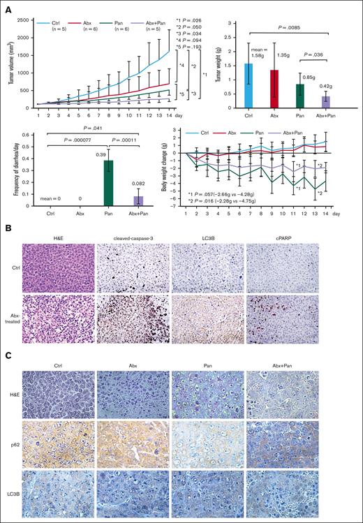 Antimyeloma effect of Abx in vivo. (A) Growth inhibition of xenografted tumor and safety of Abx treatment in male, 5-week-old ICR/SCID mice subcutaneously inoculated with KMS11, a t(4;14)+ myeloma cell line. When the xenografted tumors reached 100 mm3, intraperitoneal injection of 100 mg/kg Abx in saline on days 1, 4, 8, and 11, and/or 5 mg/kg of panobinostat (Pan) in dimethyl sulfoxide on days 1, 3, 5, 8, 10, and 12, was started (n = 5 for ctrl, n = 6 for Abx, n = 6 for Pan, and n = 5 for Abx plus panobinostat). For toxicity evaluation, 100 mg/kg of Abx was injected on days 1, 3, 4, 5, 7, 8, 10, 12, 13, and 14, and/or 5 mg/kg or 20 mg/kg of Pan was injected on days 1, 3, 5, 8, 10, and 12. Tumor size, weight, and occurrence of diarrhea were observed every day. (B) Histopathologic observation of Abx-treated xenografts. Excised xenografts were stained with H&E and subjected to immunohistochemical staining with caspase-3 and LC-3B antibodies. (C) Immunohistochemical detection of autophagy markers (LC-3B and p62/SQSTM1) in Abx and Pan-treated xenografts. cPARP, poly ADP-ribose polymerase; ctrl, control; H&E, hematoxylin & eosin.