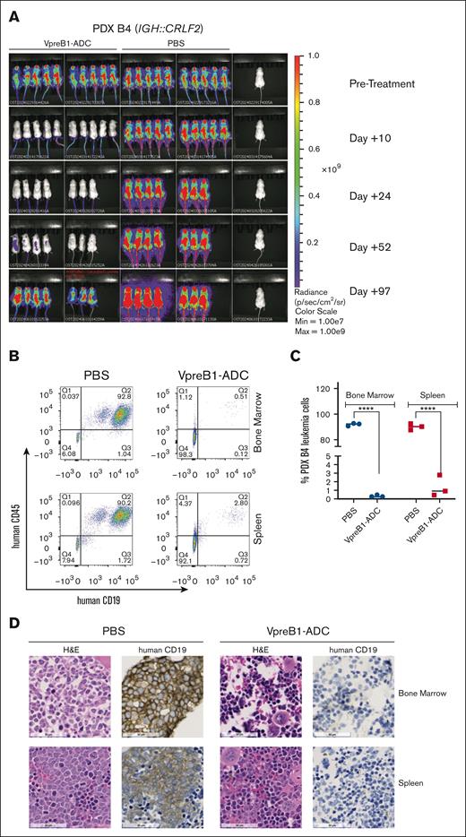 In vivo VpreB1-ADC efficacy against an IGH::CRLF2 B-ALL PDX model. NSG mice were transplanted through tail vein injection with 1 × 106 luciferase-labeled PDX model B4 cells. (A) BLI was performed pretreatment to quantify engraftment and for randomization of treatment groups. VpreB1-ADC 2 mg/kg or PBS control (n = 8 mice per group) were administered IP on days 1, 4, and 7. Mice were then followed with serial BLI until leukemia recrudescence was observed in the VpreB1-ADC–treated mice on day +97. (B-D) After 48 hours from completing the therapy, 3 mice from each group were euthanized, femurs and spleens isolated, and leukemia burden assessed using either flow cytometry (human CD19 and CD45 antibodies) or IHC (human CD19). Representative flow cytometry plots (B) with quantification (C) and IHC (D) images are illustrated. ∗∗∗∗P < .0001. H&E, hematoxylin and eosin.
