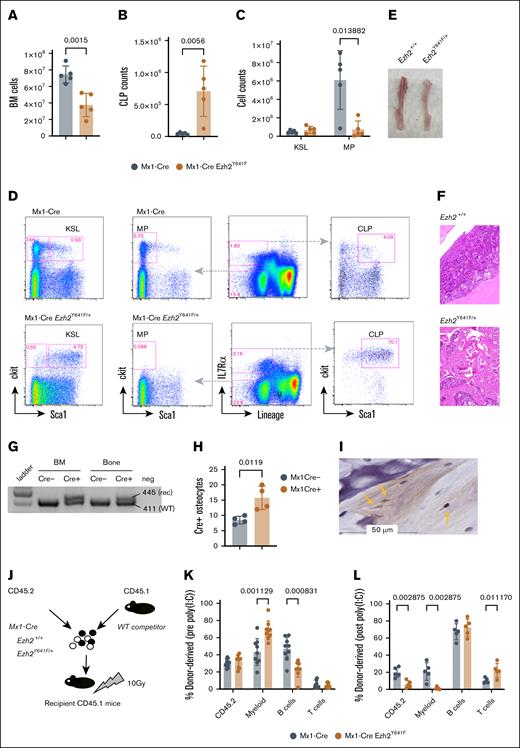 Defective cell-intrinsic hematopoietic stem cell function after induced expression of Ezh2Y641F. (A) Total BM cellularity in Mx1-Cre Ezh2Y641F mice and Mx1-Cre control mice (n = 5 per group). (B) CLP counts in BM of Mx1-Cre Ezh2Y641F and Mx1-Cre–only control mice (n = 5). (C) Analysis of KSL and MP populations. (D) Representative flow cytometry plots of BM hematopoietic progenitor populations. (E) Image of tibiae from a Mx1-Cre Ezh2Y641F mouse (right) and control (left). (F) Hematoxylin and eosin (H&E)–stained bone sections from Mx1-Cre Ezh2Y641F (bottom) and Mx1-Cre control mice (top). (G) Target allele recombination from DNA isolated from the bone and BM of the indicated genotypes. (H) Number of Cre+ osteocytes in bone sections from Mx1-Cre– and Mx1-Cre+ mice (n = 4). (I) Representative IHC image for Cre protein in Mx1-Cre+ bone sections. Yellow arrows indicate Cre+ osteocytes. (J) Workflow for competitive BM transplant assay with the indicated genotypes. (K-L) Donor cell contribution to peripheral blood chimerism before (K) and after induction (L) of Ezh2Y641F expression by poly(I:C) (n = 8 mice per group). Error bars represent standard deviation. P values as indicated, multiparameter t test. BM, bone marrow; CLP, common lymphoid progenitor; KSL, ckit+ Sca1+ lineage-negative; MP, myeloid progenitor; rec, recombination; WT, wild-type.