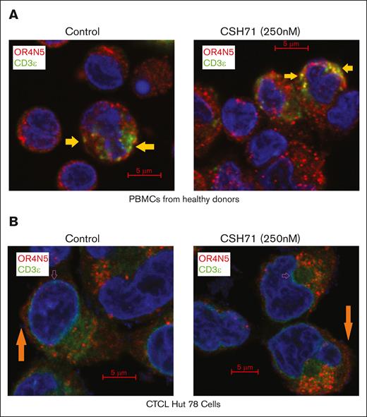Colocalization of OR4N5 and CD3E, and colocalization of p38γ with CD3Z in TCR complexes using confocal immunofluorescence microscopy. (A) Colocalization of OR4N5 and CD3E in PBMCs from healthy donors. (B) Colocalization of OR4N5 and CD3E in CTCL Hut78 cells, both treated with CSH71 (250 nM) and untreated controls. In both panels A and B, the interaction between CD3E and OR4N5 was assessed, with colocalization indicated by the yellow signal in merged 2-color images.