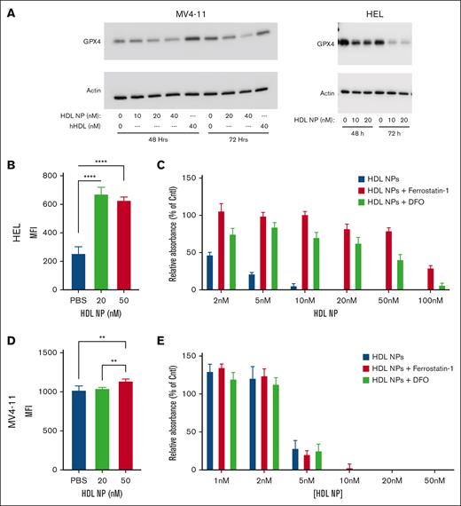 HDL NPs reduced GPx4 expression in leukemia cell lines leading to ferroptosis in HEL cells but not MV4-11 cells. (A) Western blot of GPx4 protein expression in MV4-11 (left) or HEL (right) leukemia cells treated with either PBS; HDL NPs at 10, 20, or 40 nM; or human native HDL for 48 and 72 hours. (B) C11 BODIBY oxidative lipid assay in HEL cells after treatment with HDL NPs at 20 or 50 nM. (C) Viability (MTS) assay of HEL cells treated at 2 to 100 nM HDL NPs without (red bars) or with the iron chelator Fer-1 (blue bars) and DFO (green bars). (D) C11 BODIBY oxidative lipid assay in MV4-11 cells after treatment with HDL NPs at 20 or 50 nM. (E) Viability (MTS) assay of MV4-11 cells treated at 2 to 100 nM HDL NPs without (red bars) or with iron chelator Fer-1 (blue bars) and DFO (green bars). Cntl, control; hHDL, human HDL.