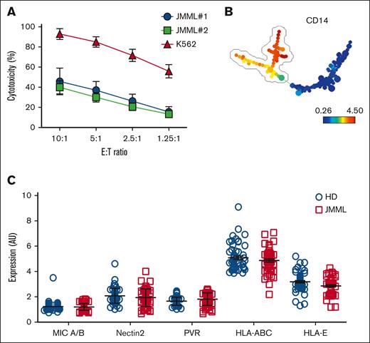 The major population of mature monocytic JMML cells are similar to HD peripheral blood monocytes in NK cell ligand expression and are relatively resistant to NK cell lysis. (A) NK cells were cocultured with target cells at different E:T ratios (10:1, 5:1, 2.5:1, and 1.25:1). JMML cells (n = 2 patient samples) were used as targets in a standard cytotoxicity assay. K562 cells were used as a positive control for NK cell cytotoxicity. (B) PBMCs of 5 HDs and 5 patients with JMML were stained with CD14-FITC, CD33-APC, and PE-labeled anti-MIC A/B, CD112, CD155, HLA-ABC, or HLA-E Abs (all m-a-h IgG1), or isotype control, washed and analyzed immediately by flow cytometry. Data were acquired using a fluorescence-activated cell sorting (FACSCalibur) cytometer. Data were preanalyzed using FlowJo to gate live cells based on side and forward scatter and 7-aminoactinomycin D exclusion. Gated events were exported into a new FCS3 file, totaling 60 files. FCS3 files were uploaded into SPADE and analyzed collectively. A minimum spanning tree was constructed based on forward and side scatter and expression of CD33 and CD14. CD14+CD33+ nodes were identified as monocytes. (C) MIC A/B, Nectin2, PVR, HLA-ABC, and HLA-E expression levels on CD14+CD33+ monocytes were analyzed from HDs and patients with JMML. AU, arbitrary units; HD, healthy donor; MIC, Major histocompatibility complex class I-related chain A and B; PVR, poliovirus receptor.