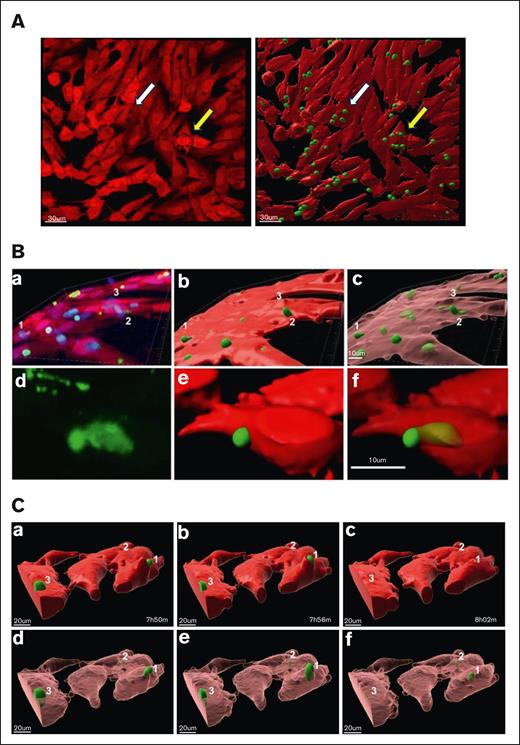 Fixed confocal images of CIC structures. Images are acquired with Leica TCS SP8 FSU laser scanning confocal microscope using a 40× oil lens. CLL cells cytoplasm are labeled in green and the BMF cytoplasm in red. (A) Vacuole-like holes are present in the cytoplasm of BMF (a), where they are occupied by CLL cells (b). Comparison white to white and yellow to yellow arrows in panel Aa-b. Bar = 30 um. (B) Two-dimensional (2D) images with green tumor cells, red BMF, and the nuclei of BMF and CLL are in blue (a); 3D images reconstructed using Imaris v10.0.; BMF cells are visualized as the red surfaces and CLL cells as the green surfaces (b); red surfaces are transformed to a transparent state (c); the entry process (d-f). (C) Time-lapsed microscopy showing CLL cells are internalized, remain viable, and move within the BMF. BMF are visualized as either red or transparent pink and CLL cells as the green surfaces (scale bar, 20 μm); track cell 1, 2, and 3 through (a-c); and compare solid images (a-c) with the corresponding transparent images (d-f).