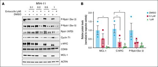 Enitociclib has effective on-target activity in KMT2A-r leukemia cells. (A) MV4-11 (KMT2A-r) cells were treated with varying concentrations of enitociclib and respective DMSO control for 6 hours. Western blot was performed to measure changes in Ser 2 phosphorylation of Rpb1, as well as changes in protein levels of MCL-1 and c-MYC after enitociclib treatment. Western blots are representative images of 3 independent biological repeats. (B) Densitometry analysis shows changes in protein levels of MCL-1 and c-MYC as well as changes in phosphorylation levels at Ser 2 of Rpb1 from 3 independent biological experiments. For group comparisons, 1-way analysis of variance test was used. ∗P < .05; ∗∗P < .01; ∗∗∗P < .001; ∗∗∗∗P < .0001. NTD, Amino-Terminal Domain; P-Rpb1, Phospho-RNAP II subunit B1.