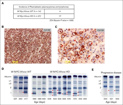 Increased tumor incidence in Vk∗MYC:Wwox KO mice with high CD138+ expression and uropod formation in PBPs. (A) A significantly higher number of Vk∗MYC:Wwox KO mice (17/27) developed PBTs and BCLs compared to Vk∗MYC:Wwox WT mice (4/14), as determined by χ2 analysis (P = .036). (B) Low-magnification photomicrograph of extramedullary PBP histology section from a Vk∗MYC:Wwox KO mouse immunostained with anti-CD138 antibody. Scale bar on lower left, 400 μm in length. (C) High-magnification photomicrograph of histology section from another Vk∗MYC:Wwox KO PBP displaying areas of cells with immunostained uropod-like structures, that is, polarized intracellular CD138 staining to small membrane protrusions (red arrows). Scale bar on lower left, 100 μm in length. (D) Representative SPEP of serum samples from Vk∗MYC:Wwox WT and KO mice. Red arrows indicate representative M-spikes. (E) Representative longitudinal follow-up of serum samples analyzed by SPEP collected from the same mouse through time, displaying progressive disease with a marked increase in M-spike intensity over time.