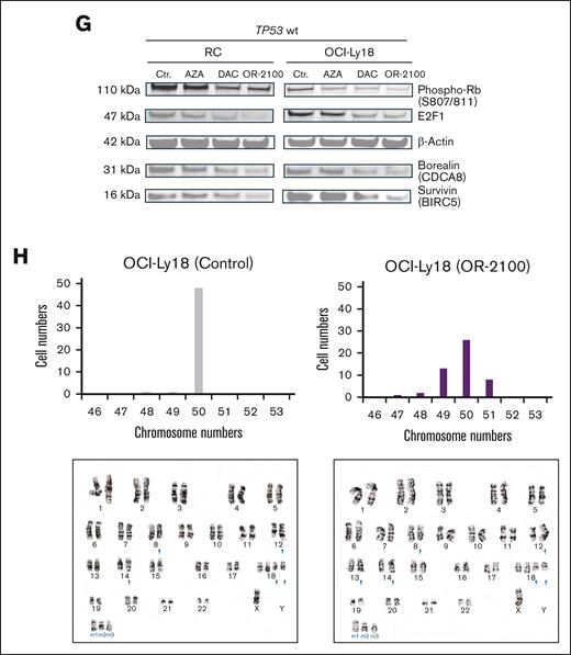 OR-2100 downregulates mitosis-related molecules via an E2F-mediated pathway, leading to mitotic perturbation and chromosomal aberration. (A) Schematic image of the cell cycle and multipolar spindles. (B) Representative images of OCI-Ly18 cells (left, shCtr; middle, shCDCA8; right, OR-2100-treated). Immunofluorescence images were captured at the original magnification ×100; α-tubulin (green) and DAPI (blue). (C) The quantification of aberrant spindles was conducted using IHC; the percentage of aberrant spindles were significantly increased among TP53 wt cells. (D) Flow cytometry analysis was performed to detect the percentage of cells with a >4N karyotype. The percentage of abnormal OCI-Ly18 cells that harbored a >4N karyotype was significantly increased by OR-2100 treatment when compared with AZA treatment, whereas that of SU-DHL-6 cells was increased modestly (gray, Ctr; red, AZA; purple, OR-2100). (E) The expression of β-tubulin, borealin (CDCA8), and survivin (BIRC5) in OCI-Ly18 cells and SU-DHL-6 cells treated with HLM006474 (an E2F inhibitor), as measured by western blotting. The expression of borealin and survivin protein decreased in OCI-Ly18 cells but not in SU-DHL-6 cells. (F) The cell viability assays conducted for RC cells and OCI-Ly18 cells treated with HLM006474. HLM006474 inhibited the growth of RC cells and OCI-Ly18 cells. (G) The phosphorylation of Rb (S807/811), E2F1, β-actin, borealin (CDCA8), and survivin (BIRC5) in RC cells and OCI-Ly18 cells treated with HMAs (AZA, DAC, and OR-2100) was measured by western blotting. Representative images show that the expression of phosphorylated Rb (S807/811), E2F1, borealin, and survivin decreased in the presence of DAC and OR-2100 to a greater extent than in the presence of AZA. (H) Chromosomal analysis of the OCI-Ly18 cells. (gray, Ctr; purple, OR-2100 treated). Cell and chromosome numbers are shown with the images of G-banding analysis (left, Ctr; right, OR-2100 treated). E2Fi, E2F1 inhibitor; Mut, mutation; ns, not significant; Phospho-Rb, phosphorylated retinablastoma protein; wt, wild type. Panel A created with BioRender.com.