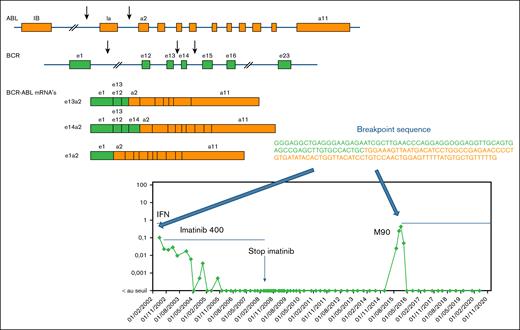 Late MRec. For the patient with the MRec at month 90, BCR::ABL1 breakpoints were sequenced at both diagnosis and MRec to check if it was the same disease. DNA was sent to the Institute of Hematology and Blood Transfusion, Department of Molecular Genetics, Prague, Czech Republic. The library was prepared using the Illumina Nextera Rapid Capture Custom Enrichment protocol. For the enrichment of sequences covering the BCR::ABL1 breakpoint, a custom probe set developed by Thomas Ernst and colleagues from Jena was used. This panel consists of 4608 probes, targeting both the BCR gene region (23522352-23660424) and the ABL gene region (133589068-133763262). The cumulative target length in this setting is 312 268 bp. The library was quantified using Quant-iT PicoGreen, and its quality was controlled using an Agilent Technologies 2100 Bioanalyzer with a DNA 1000 chip. The library was then sequenced on a MiSeq system using the MiSeq reagent kit v3 with 2 × 250 cycles. The BCR::ABL1 breakpoints were determined by bioinformatics processing using NextGene Software in a structural variant detection workflow. The sequence of the breakpoint from the diagnostic sample was strictly similar as compared with the sample from the MRec sample.