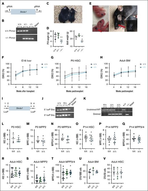 Skida1 is not required for normal hematopoiesis or HSC function during fetal, neonatal, or adult stages. (A) Diagram of Skida1 germ line loss-of-function allele with vertical arrows indicating cut sites around the single coding exon to generate Skida1 null mice. (B) Representative genotyping polymerase chain reaction (PCR) of the deleted Skida1 allele. (C) Representative pictures of P21 Skida1−/− (right) and Skida1+/+ littermates (left). (D) Body weights for Skida1+/+, Skida1+/−, and Skida1−/− mice at P14 and age 8 weeks. P14 n = 10 (+/+), n = 7 (+/−), n = 6 (−/−); age 8 weeks, n = 3 (+/+), n = 4 (+/−), n = 4 (−/−). ∗∗P < .01; ∗∗∗P < .001 by 1-way ANOVA with the Tukey post hoc test. (E) Representative pictures of eye defects in Skida1−/− mice at P0 and age 8 weeks. (F-H) CD45.2+ peripheral blood chimerism levels in recipients of E16 fetal liver cells, P0 HSCs or age 8 weeks BM cells from donors with the indicated genotypes. E16 recipients: n = 17 (+/+), n = 18 (−/−); P0 recipients: n = 17 (+/+), n = 19 (−/−); and aged 8 weeks recipients: n = 9 (+/+), n = 8 (−/−). (I) Diagram of Skida1 conditional loss-of-function allele. LoxP sites were inserted around the single coding exon by Cas9 editing and homologous recombination. Genotyping primer sites (1-4) are indicated. (J) Representative genotyping PCR for the Skida1fl allele. (K) Representative PCR indicating complete deletion of the floxed allele in CD45.2+ peripheral blood cells from Skida1fl/fl;Vav-Cre mice. (L-T) Total cell numbers of indicated populations and genotypes in P0 whole liver, or P14 or adult BM from 2 hind limbs (tibia and femur). P0: n = 4 (fl/fl), n = 7 (Δ/Δ); P14: n = 8 (fl/fl), n = 12 (Δ/Δ); adult: n = 15 (fl/fl), n = 9 (+/Δ), n = 14 (Δ/Δ). (U-V) CFU frequencies generated from 1000 whole BM cells or sorted HSCs from adult mice with the indicated genotypes. Whole BM: n = 8 (fl/fl), n = 4 (+/Δ), n = 8 (Δ/Δ); HSCs: n = 7 (fl/fl), n = 4 (+/Δ), n = 7 (Δ/Δ). None of the comparisons in panels L through V indicated significant differences among the genotypes, as calculated by Student t test or 1-way ANOVA with the Tukey post hoc test. BM, bone marrow; gRNA, guide RNA; WT, wild type.