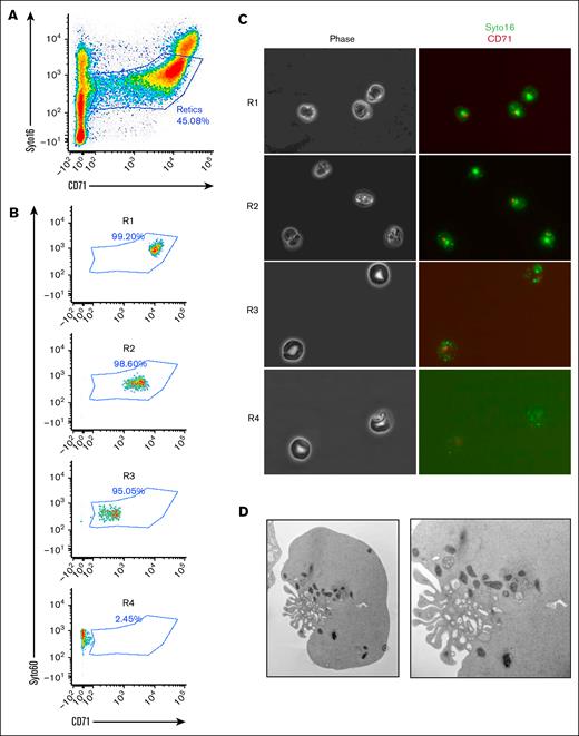 Resolving the heterogeneity of human nascent reticulocytes. (A) Gating strategy using CD71 and SYTO16 as surface markers. (B) Four populations of reticulocytes (R1-R4) can be isolated and sorted based on the 2 surface markers. (C) Morphology of sorted reticulocyte populations by phase contrast microscopy (left panels), and immunofluorescence (right panels). (D) Transmission electron microscopy of a nascent reticulocyte highlighting numerous ruffles and organelles.