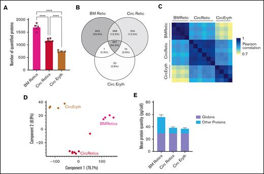 Comparison of nascent reticulocytes proteome (BMRetic) with Gautier et al25data of mature reticulocytes (CircRetic) and purified circulating erythrocytes (CircEryth). (A) Mean number of quantified proteins in each population. Statistics: 1-way analysis of variance; ∗∗∗∗P < 0001. (B) Venn diagram of quantified proteins in each population (proteins quantified in at least 1 sample). (C) Pearson correlations of log2(protein copy numbers per cell) between each sample. (D) Mean quantity (in picograms per cell) of globins and other proteins in each population. (E) Principal component analysis of log2(protein copy numbers per cell) of every sample (proteins with at least 70% of valid values in at least 1 condition were selected). BM, bone marrow.