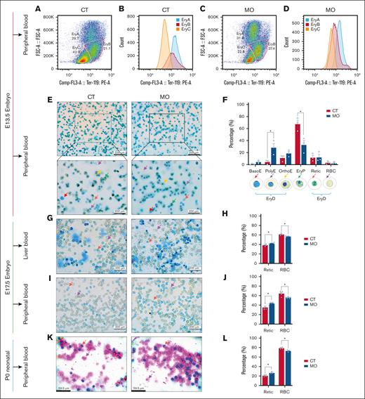 MO delays terminal maturation in mouse embryonic erythrocyte. (A-D) Flow cytometry analysis of fetal peripheral blood at E13.5, identifying EryA, EryB, and EryC populations based on FSC-A and Ter119 expression. (E) Representative peripheral blood smears stained with new methylene blue at E13.5. The top panels were imaged at 100× magnification and the bottom panels at 400× magnification. (F) Proportional analysis of erythroid cells in peripheral blood at E13.5. (G-H) Representative images of new methylene blue–stained liver blood cells at E17.5 (G, 400× magnification), with corresponding quantification (H). (I-J) Representative images of new methylene blue staining in peripheral blood cells at E17.5 (I, 400× magnification), and quantification of the staining (J). (K-L) Representative images of Giemsa-stained neonatal peripheral blood cells at P0 (K, 400× magnification), with corresponding quantification (L). Data are presented as mean ± SEM; each dot represents an individual embryo. For all experiments, embryos from 3 to 6 pregnancies per group were used. For flow cytometry, one embryo was selected from each pregnancy, and fetal blood from these embryos was pooled within each group (CT or MO) to generate a single sample for analysis. Statistical significance was determined by unpaired 2-tailed t test. ∗P < .05. Colored arrows in the representative images indicate typical erythrocytes at different developmental stages. BasoE, basophilic erythroblast; PolyE, polychromatic erythroblast; OrthoE, orthochromatic erythroblast; Retic, reticulocyte.