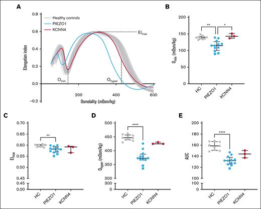 RBC deformability measured by osmotic gradient ektacytometry in HX. (A) Representative osmotic gradient ektacytometry curve of a patient with PIEZO1-HX (blue) and a patient with KCNN4-HX (red). (B) Median values of Omin, representing surface area-to-volume ratio, of 12 patients with PIEZO1-HX, 3 patients with KCNN4-HX, and 9 HCs. (C) Median values of EImax, representing the total surface area and maximal deformability of the RBC population. (D) Median values of Ohyper, representing the hydration of RBCs. (E) Median values of AUC. Error bars represent IQR. ∗∗∗∗P < .0001; ∗∗P < .01; ∗P < .05. Square symbols indicate splenectomized patients.