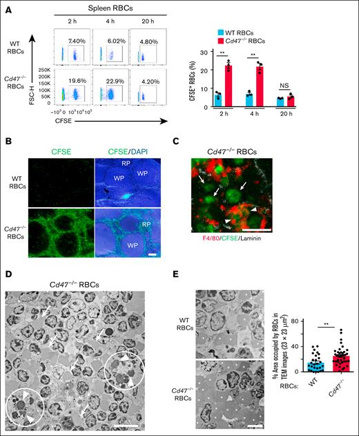 Transfusion of Cd47−/− RBCs into WT recipient mice results in retention of these cells in RP. (A) Representative flow cytometric plots (left panel) and the percentage (right panel) of CFSE-positive RBCs among total splenic RBCs of WT recipient mice at 2, 4, and 20 hours after IV injection of CFSE-labeled WT or Cd47−/− RBCs. The data in the right panel are means ± SEM for 3 recipient mice. (B) Representative fluorescence microscopic images of frozen sections for the spleen of WT recipient mice at 2 hours after IV injection of CFSE-labeled WT or Cd47−/− RBCs. Fluorescence images for CFSE (green) with or without DAPI (blue) are shown. Scale bar, 200 μm. (C) Representative fluorescence microscopic image of a frozen section for the spleen of a WT recipient mouse at 2 hours after IV injection of CFSE-labeled Cd47−/− RBCs (green). The section was also subjected to immunohistofluorescence analysis with antibodies to F4/80 (red) and to laminin (white). Scale bar, 10 μm. Arrowheads and arrows indicate CFSE-labeled Cd47−/− RBCs that are surrounded or not surrounded by F4/80-positive signals, respectively. (D) Representative TEM image of a spleen section from a WT recipient mouse at 2 hours after IV injection of Cd47−/− RBCs. The white circles include RPMs that appear to be engaged in phagocytosis of RBCs (arrowheads). The arrows indicate RBCs that are localized independently of RPMs. Scale bar, 10 μm. (E) Representative TEM images of RP for WT recipient mice at 2 hours after IV injection of WT (upper left panel) or Cd47−/− (lower left panel) RBCs. Asterisks indicate RBCs positioned independently of RPMs. Scale bar, 5 μm. The percentage area occupied by RBCs in such TEM images (23 × 23 μm2) of RP in WT recipient mice is also revealed (right panel). The data are means ± SEM for 30 TEM images from 3 mice. ∗∗P < .01 by Student t test (panels A,E). DAPI, 4′,6-diamidino-2-phenylindole; FSC-H, forward scatter height; NS, not significant; RP, red pulp; WP, white pulp.