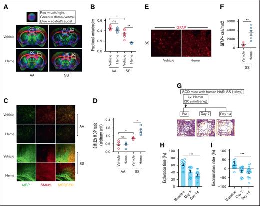 Heme-induced microstructural neuroaxonal damage is associated with poor cognitive responses in SCD mice. (A-B) Representative DTI image from AA and SS mice challenged with vehicle or heme and quantitation of FA (n = 6; M, 3; F, 3). (C-D) Elevated SMI32 accumulation compared to MBP and quantitation of staining intensity (SMI32/MBP ratio) indicating increased white matter injury in the SS mice at 24 hours following heme challenge (n = 5; M, 3; F, 2; original magnification ×20). (E-F) Representative photomicrograph and quantitation of GFAP-positive (GFAP+) astrocytes in cerebral tissue sections from SS and SSH mice (original magnification ×20; n = 6; M, 4; F, 2). (G-I) The SS mice were subjected to NOR testing at baseline followed by 7-days and 14-days post-heme challenges in a longitudinal fashion (n = 14; M, 8; F, 6). (G) Representative track plot from NOR testing showing halted movement of SS mice at day 7 and 14 following heme challenge compared to their baseline movement. (H-I) Memory and learning behavioral parameters including the exploration time (H), discrimination index (I) during NOR testing in the SS mice prior to and following heme injection indicating poor cognitive responses following heme challenge. Unpaired t test for panels B,D,F; 1-way ANOVA for panels H-I. ∗P < .05, ∗∗P < .01, ∗∗∗P < .001. F, female mice; M, male mice; ns, not significant.