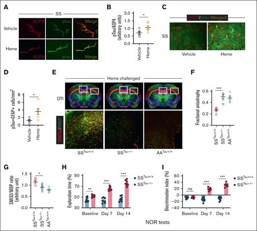 The critical involvement of Tau in the heme-mediated neurocognitive responses in SCD mice. (A-B) Representative photomicrograph and relative fluorescence intensity for the expression of pTau in the isolated cerebral microvessels from vehicle (SS) and heme (SSH) injected SCD mice showing coexpression of pTau and aquaporin 4 (AQP4), marker for astrocytes adjacent to cerebral microvascular endothelium (original magnification ×20). (C-D) Representative photomicrograph and fluorescence intensity quantitation showing expression of pTau in heme-induced SS mice associated with GFAP+ reactive astrocytes. Arrows indicate coexpression of GFAP and pTau in some astrocytes (original magnification ×20). (n = 6; M, 3; F, 3). (E-G) Sickle bone marrow chimera mice with (SSTau+/+) or without (SSTau˗/˗) Tau deficiency in nonhematopoietic tissues, and control (AA) bone marrow transplanted Tau+/+ mice (AATau+/+) were challenged with heme and tested for neuroaxonal damage. Representative images showing DTI scans and SMI32/MBP expression within the indicated regions of corpus callosum and external capsule (original magnification ×20) from heme injected SSTau+/+, SSTau˗/˗ and AATau+/+ mice (E), quantitation of FA (F), and SMI32/MBP intensity (G) demonstrating reduced neuroaxonal damage in absence of Tau (n = 6; M, 3; F, 3). (H-I) Improved exploration time (H) and discrimination index (I) in SSTau˗/˗ mice compared to SSTau+/+ mice (n = 8; M, 3; F, 5) observed during NOR testing at baseline, day 7, and day 14 following heme challenge. Unpaired t test between the indicated experimental groups. ∗P < .05, ∗∗P < .01, ∗∗∗P < .001. M, male mice; F, female mice; ns, not significant.