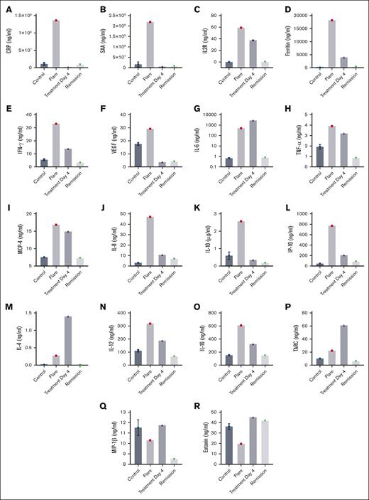 Cytokine and chemokines in iMCD-TAFRO. Array 1 shows plasma levels for CRP (A), serum amyloid A (SAA) (B), ferritin (D), IFN-γ (E), VEGF (F), IL-6 (G), TNF-α (H), MCP-4 (I), IL-8 (J), IL-10 (K), IP-10 (L), IL-4 (M), IL-12 (N), IL-16 (O), thymus- and activation-regulated chemokine (TARC) (P), macrophage inflammatory protein 1β (MIP-1β) (Q), and eotaxin (R). (C) sIL2Rα (CD25) was determined by ELISA. Array 1 and ELISA results are for controls (Controls), flare (Flare), 4 days after treatment (Treatment Day 4), and during remission (Remission) 6 months later.