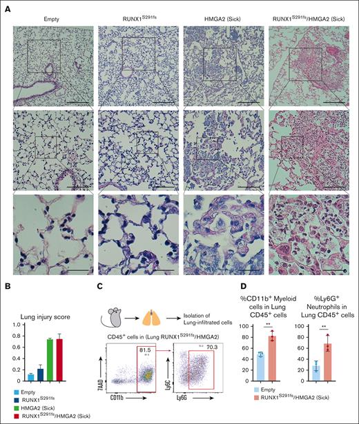 HMGA2 overexpression in HSC/Ps causes lethal noninfectious pneumonia in MDS mice. (A-B) H&E staining of lung section from indicated mice. Scale bars: top panels, 250 μm (original magnification ×40); middle panels, 50 μm (original magnification ×100); and bottom panels, 25 μm (original magnification ×400). Lung injury score of individual samples is shown in panel B (n = 3 per each group). More than 10 random high-power fields were scored. Data are presented as the mean ± SD. (C-D) Flow cytometric analysis of lung-infiltrated cells of indicated mice (n = 3 per each group). Frequencies of CD11b+ myeloid cells and Ly6G+ neutrophils within lung-infiltrated cells are shown in panel D. Data are presented as the mean ± SD. ∗∗P < .01.