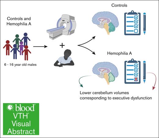 Children with severe HA compared to healthy controls demonstrated lower cerebellar gray matter volumes which corresponded to executive dysfunction.