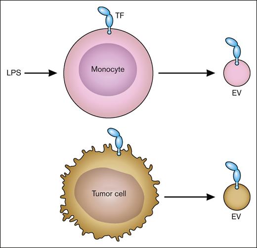 TF-positive EVs. LPS-stimulated monocytes express TF and release TF-positive EVs. Tumor cells also constitutively release TF-positive EVs. Professional illustration by Patrick Lane, ScEYEnce Studios.