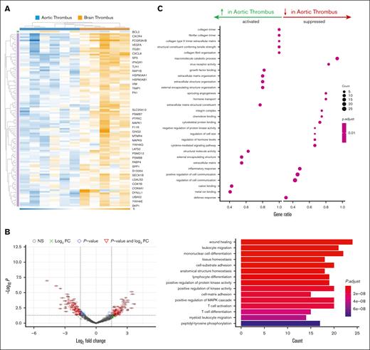 Transcriptomic analysis of arterial thrombus from different vascular beds. RNA was extracted and the expression of genes involved in inflammation and fibrosis was determined in arterial thrombi extracted from patients with infrarenal (n = 6) at the time of surgical repair or from the brain after acute thrombotic stroke (n = 5) at the time of catheter thrombectomy. (A) Heat map and (B) Volcano plot and Gene Ontology analysis for biological pathways in the thrombus. (C) Cellular and biochemical processes increased or decreased in aortic thrombus with respect to brain thrombus. FC, fold change.