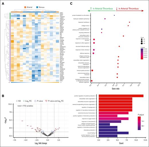 Transcriptomic analysis of arterial thrombus from different vascular beds. RNA was extracted, and the expression of genes involved in inflammation and fibrosis was determined in arterial thrombus extracted from patients with infrarenal AAA (n = 6) at the time of surgical repair or from the brain following acute thrombotic stroke (n = 5) at the time of catheter thrombectomy. (A) Heat map and (B) Volcano plot and Gene Ontology analysis for biological pathways in the thrombus. (C) Cellular and biochemical processes increased or decreased in aortic thrombus with respect to brain thrombus. FC, fold change.