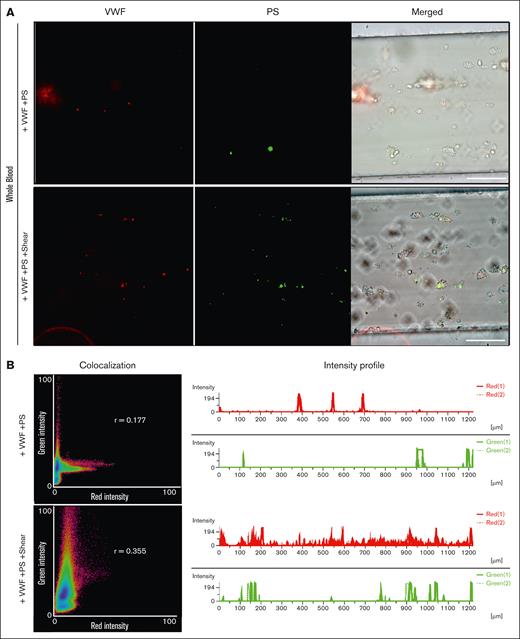 The PS/VWF complex is stable under flow. Whole blood was supplemented with 10 μg/mL AlexaFluor555-conjugated VWF and 200 nM AlexaFluor488-conjugated PS and perfused through collagen-coated channels at 35 dyn/cm2. Experiments were performed either without or with PS/VWF vortexing. (A) Images taken after flushing with buffer; scale bar, 100 μm. (B) Colocalization (shown is Pearson correlation r) and intensity profile analyses using the Nikon Instruments Software Element software.