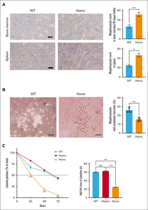 Mgks in bone marrow, proplatelet formation, and platelet life span. (A) Mgks in the bone marrow from the femur and spleen were assessed under an optical microscope (left). Mgks were detected by staining with anti-VWF antibodies. The counts of Mgks in 10 visual fields (200× original magnification) were determined (right). (B) Murine fetal liver cells were harvested from embryonic day 13.5 embryos and cultured with murine TPO. Proplatelet formation was monitored 4 days after the addition of TPO. Images were obtained using the BX51 microscope (Olympus) with 20× objective (left). The scale bars represent 50 μm. The percentages of proplatelet-forming Mgks are demonstrated in the right panel. The results are presented as the mean and SD. Representative results of 2 independent experiments are shown (n = 6). (C) Mice were injected with 600 μg of NHS-biotin via the murine tail vein on day 0, and the percentages of biotinylated platelets at various time points were assessed via flow cytometry. The results are presented as the mean and SD (n = 3 each). ∗∗∗P < .001 (unpaired t test). ns, not significant.