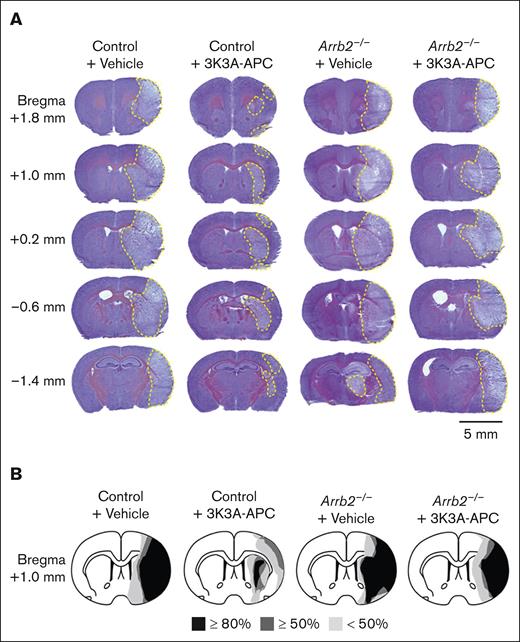 3K3A-APC reduces postischemic injury areas in control mice but not in Arrb2–/– mice. (A) Representative images of cresyl violet staining of brain sections 24 hours after tMCAo from control and Arrb2–/– mice on a C57BL/6J genetic background treated with vehicle or 3K3A-APC as in Figure 1. Injury areas are delineated by yellow dashed lines. Mice used for representative images in panel A are the same as in Figure 2A. The tissue sections for cresyl violet staining were taken from the same locations relative to the bregma as for T2-weighted MR scans in Figure 2; scale bar, 5 mm. (B) Incidence and topography of injury area at the level of optic chiasm (ie, image for the bregma +1.0 mm) in control mice and Arrb2–/– mice treated with vehicle or 3K3A-APC. Control + vehicle (n = 6); control + 3K3A-APC (n = 6); Arrb2–/– + vehicle (n = 5); Arrb2–/– + 3K3A-APC (n = 5).