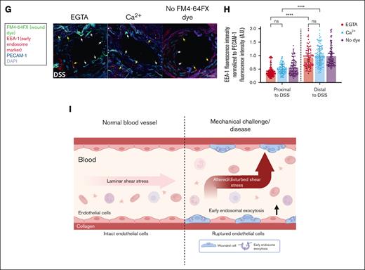 Regions of DSS in mice are prone to endothelial membrane wounds, which undergo Ca2+-mediated repair using EE. (A) C57BL/6J mice were perfused immediately after euthanasia with a buffer containing the wounding dye FM4-64FX (displayed in green), washed, and fixed. The aorta was prepared, stained for endothelial cells by anti–PECAM-1 antibodies (red) and for all cells by DAPI (4′,6-diamidino-2-phenylindole) nuclear stain (blue), and imaged by confocal microscopy. FM4-64FX was perfused either in the presence of Ca2+ or the Ca2+ chelator, EGTA, to study the role of Ca2+-dependent membrane repair, and perfusions without FM4-64FX served as the no dye negative control. Representative images of regions of laminar SS (LSS; top) and DSS in the aorta (bottom) are shown, also marked in the schematic of the mouse aorta on the left. The schematic of the aorta shows the regions of LSS (blue line) and DSS (orange line) examined, with the potential flow profiles in these regions depicted with gray arrows. The FM4-64FX signal was considered to indicate wounded cells, only if it correlated to PECAM-1–stained endothelial cells and a corresponding DAPI signal. Note that enhanced FM4-64FX signal (labeled with white arrows) was specifically observed in regions of DSS around the branches of arteries, and no staining was seen in the no dye control. High magnification images of LSS (blue dashed box) and DSS regions (orange dashed box) are shown on the right. The FM4-64FX localizations around the branches are clearly distinct from the background punctae observed in all cells, and some are indicated with white arrows (also see supplemental Figure 3). (B) Quantifications of FM4-64FX positive endothelial cells in DSS and LSS regions of the aorta are represented as cell counts per 104 μm2 of aorta area. Wounded endothelial cells were only observed in regions of DSS (separated from LSS regions by a dashed black line in the graph). Note the wounded endothelial cell counts are significantly higher in perfusions with EGTA (red circles) than Ca2+ (blue triangles) or no dye controls (purple diamonds). Legend on the right indicates the various perfusion conditions, also for all further graphs. (C) Wound dye perfusions into mice were performed as above, and along with the aorta, the superior vena cava, pulmonary artery, and pulmonary vein were examined (marked on the images and in the schematic on the left as “1” indicating the aorta, “2” marking vena cava, and “3” and “4” labeling the pulmonary artery and vein, respectively). No FM4-64FX signal corresponding to PECAM-1–stained cells could be seen in vessels other than aorta (white arrows) in all conditions, indicating no inherent membrane damage in these other vessels. (D) Quantifications of the wounded cell counts in panel C. (E) Mice were perfused with FM4-64FX wound dye (shown in green), washed, and then perfused again with a second dye, Live-or-Dye Fix 488 (red), washed, fixed and aorta sections were stained for PECAM-1 to label endothelial cells (dark blue) and with DAPI to label all cells (light blue), as above. Wound-tracking dyes were perfused either in the presence of Ca2+ or the Ca2+ chelator, EGTA, to study the population of cells undergoing Ca2+-dependent membrane repair, and perfusion without both wound dyes served as the no wound dye negative control. High magnification images of DSS regions are shown here (also see supplemental Figure 4A for a fluorescence overview). Along with the FM4-64FX signal around branches (white arrows marking wounded endothelial cells), Live-or-Dye signal was also noted (yellow arrows) in PECAM-1–labeled cells, indicative of wounded and non-repaired endothelial cells. This Live-or-Dye signal is significantly higher in EGTA conditions, suggesting an active Ca2+ dependent repair mechanism. (F) Percentages of the non-repaired endothelial cells (Live-or-Dye positive) as in panel E are represented relative to the total number of wounded (FM4-64FX–positive) endothelial cells across the perfusion conditions. Note that cells under EGTA perfusion show a major defect in membrane repair, as opposed to those cells in the presence of Ca2+ (see supplemental Figure 4D for the repaired cell analyses). (G) FM4-64FX wound dye perfusions into mice were performed as before, and after fixation and dissection, the aorta was stained for EE with anti–EEA-1 (early endosome antigen 1) antibodies (red), with anti–PECAM-1 antibodies to identify endothelial cells (dark blue), and with DAPI to label all cells (light blue). Zoomed-in regions of DSS are displayed (see supplemental Figure 5A for low zooms). Punctate EEA-1 staining can be observed in all PECAM-1–stained endothelial cells. FM4-64FX–positive wounded cells around branches (indicated with white arrows in zooms) showed reduced EEA-1 staining as compared to unwounded PECAM-1–positive cells without FM4-64FX stain or PECAM-1 cells far from the curvature (both indicated with yellow arrows). (H) EEA-1 fluorescence intensities were measured in endothelial cells around the DSS exposed branches (as in panel G; labeled “Proximal to DSS” on the x-axis) and in cells far away from the branches (“Distal to DSS”), normalized to the corresponding PECAM-1 endothelial cell signals, and plotted. Note that the cells around the bifurcation show significantly reduced EEA-1 staining (separated from distal region measurements in the graph by a dashed black line), indicating early endosomal involvement in membrane wound repair. (I) Model showing the membrane damaging effect of SS of blood flow on the endothelial lining of a blood vessel, which occurs upon mechanically challenging alterations or disturbances in SS of blood flow. Scale bars represent 20 μm in panels A and C and 10 μm in zoom-ins in panels A, E, and G. Mean ± SD with the distribution of all samples shown for the graphs (n = 36-103 fields of view pooled from 14 mice in panel B; 13-73 regions from 6 mice in panel D; 10-20 regions each combined from 3 mice in panel F; and 133-191 cells from 3 mice in panel H). Statistical comparisons using 1-way ANOVA with the Kruskal-Wallis test were performed for all analyses. ∗P < .05; ∗∗P < .01; ∗∗∗P < .001; ∗∗∗∗P < .0001. ns, not significant.