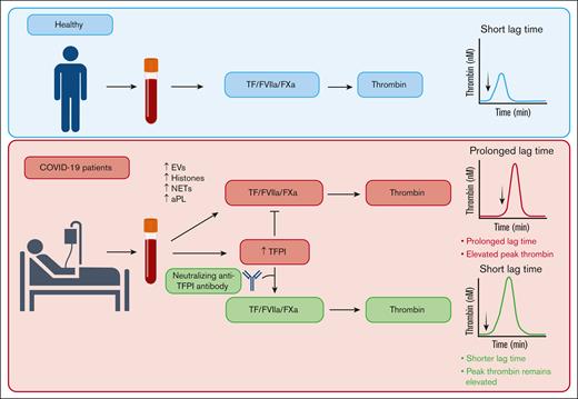 Summary of effects of elevated plasma TFPI on thrombin generation in patients with COVID-19. COVID-19 enhances thrombin generation via multiple mechanisms, including EVs, histones, NETs, and aPL.13 Elevated plasma TFPI prolongs the lag time to thrombin generation but does not diminish peak thrombin. aPL, antiphospholipid antibody; FXa, factor Xa; FVIIa, factor VIIa; NET, neutrophil extracellular trap.