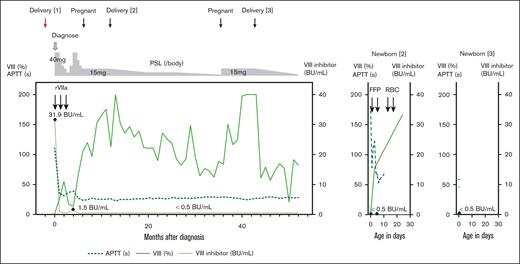 Two live births in a patient with pregnancy-associated AHA. Clinical course of a patient with pregnancy-associated AHA (left); the second (middle) and third newborns (right). FFP, fresh frozen plasma; RBC, red blood cell.
