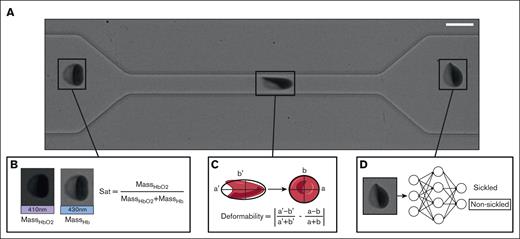Experimental methods. (A) Imaging of a single RBC traversing the microfluidic constriction. Scale bar, 10 μm. (B) Calculation of single-cell oxygen saturation uses absorption from a 410-nm light-emitting diode (LED) to calculate mass of oxygenated Hb, and absorption from a 430-nm LED to calculate mass of deoxygenated Hb. (C) The single-cell deformation is measured by calculating the absolute difference in cell Taylor deformation within the constriction and outside the constriction. (D) RBCs are classified as either sickled or nonsickled using a ResNet-50 CNN.