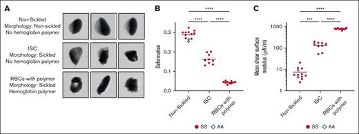 Mechanical properties of nonsickled, irreversibly sickled, and RBCs with detectable Hb polymer. (A) Representative images of nonsickled RBCs and cells classified as sickled by the CNN that have been separated into ISCs and RBCs containing polymerized Hb based on the oxygen tension and cell saturation. (B) Deformation parameter of the 3 cell types for 10 HbSS blood samples and 2 HbAA blood samples. (C) Mean shear surface modulus of the 10 HbSS blood samples and HbAA blood samples calculated from the corresponding deformation parameter. A 1-way analysis of variance was used to identify significant differences, and a Dunnett test was used to compare the subpopulations.