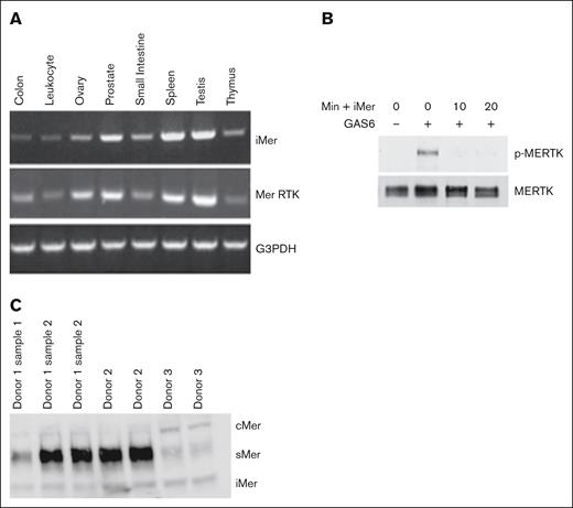 iMer is expressed in gastrointestinal, genitourinary, endocrine, and lymphatic tissues, and inhibits phosphorylation of MERTK induced by GAS6. (A) iMer and full-length MERTK transcripts were detected by reverse transcription PCR, with G3PDH as loading control, from C57BL/6 wild-type mouse tissue. (B) A total of 697 cells treated with vehicle control or with iMer for 10 or 20 minutes as indicated were cultured with or without 200 nM GAS6 to activate MERTK receptor. MERTK was then immunoprecipitated. Phosphorylated (denoted by p-MERTK) and total MERTK proteins were detected by immunoblot. Images shown are representative of 2 independent experiments. (C) Mer isoform prevalence in platelets varies among individuals. Immunoblot of platelet lysates collected from 3 donors, 1 of whom had multiple samples collected across different days. The blots demonstrate full-length MERTK (cMer), soluble MERTK extracellular domain (sMer), and iMer. G3PDH, glyceraldehyde-3-phosphate dehydrogenase.
