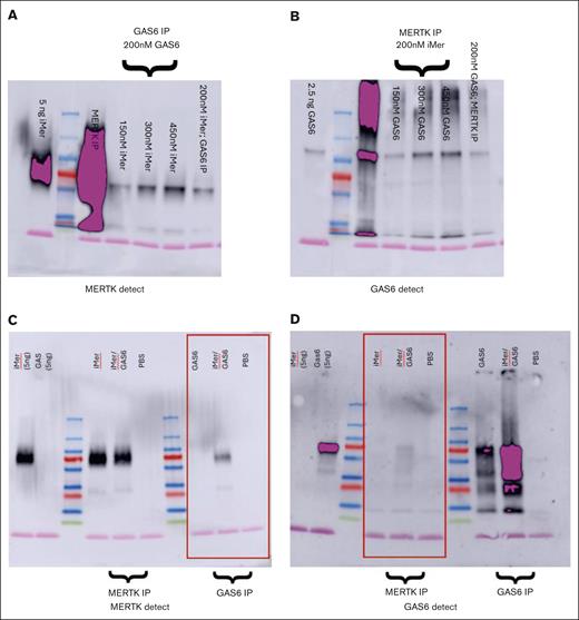 iMer and GAS6 bind directly in coimmunoprecipitation. Brackets depict protein added and blots are labeled by detection antibody as anti-MERTK (MERTK detect) or anti-GAS6 (GAS6 detect) as indicated. (A) Glutathione S-transferase–tagged GAS6/iMer complexes were detected by immunoprecipitating with anti-human MERTK antibody and immunoblotting with an anti-human GAS6 antibody. (B) Respectively, GAS6/iMer complexes were also detected when immunoprecipitated with anti-human GAS6 antibody and immunoblotting with anti-human MERTK antibody. Also shown are the input protein and same protein immunoprecipitation/immunoblot controls. (C) His-tagged GAS6 (200 nM) or 200 nM each GAS6 and iMer were immunoprecipitated with anti-human GAS6 antibody. iMer coimmunoprecipitates with the GAS6 and is detected with anti-human MERTK antibody. Also shown are control immunoprecipitations with anti-human MERTK and input iMer. (D) Respectively, 200 nM iMer or 200 nM each iMer and GAS6 were immunoprecipitated with anti-human MERTK antibody. GAS6 coimmunoprecipitates with the iMer and is detected with anti-human GAS6 antibody. Also shown are the control immunoprecipitations with anti-human GAS6 and input GAS6. Images are representative of 3 independent assays. IP, immunoprecipitation.