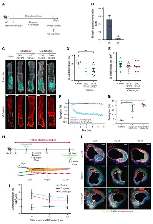 Ticagrelor but not clopidogrel increases endothelial healing and prevents neoatherosclerosis. (A) Protocol used to compare the effects of ticagrelor and clopidogrel effect on endothelial healing after vascular injury. The endovascular injury was performed in carotid arteries of wild-type (WT) mice, followed by administration of water (control), oral ticagrelor (20 mg/kg), or clopidogrel (16 mg/kg or 40 mg/kg) twice a day for 5 days. Carotid artery endothelial healing was then analyzed by en face staining. (B) Ticagrelor plasmatic concentration in mice 2 hours and 8 hours after administration. (C-E) Representative confocal images (C) and quantification of deendothelialized area of en face carotid arteries (E) stained with Evans blue or anti–VE-cadherin from the indicated treatments. Scale bar: 0.5 mm. The zone outlined in white represents the initial deendothelialized area, and the zone outlined in yellow represents the area that has not been recovered with endothelial cells. (F) Platelet aggregation of WT mice treated with ticagrelor and clopidogrel following ADP stimulation (10 μM). (G) Quantification of tail bleeding time of mice treated with vehicle (control), ticagrelor (n = 4), or clopidogrel (n = 4). (H) Protocol used to investigate ticagrelor impact on atherosclerosis development after vascular injury in vivo. Seven-week-old LDLR–/– mice were fed a 1.25% cholesterol diet for 35 days. Endovascular injury was performed in carotid arteries on day 14 and then treated by oral administration of ticagrelor (20 mg/kg) or clopidogrel (16 mg/kg) twice a day for 5 days (upper panel). Atherosclerotic plaque development was then analyzed by immunohistochemistry on day 35 as schematized in the lower panel. (I) Atherosclerotic lesions were measured on histological sections located 0, 50, and 100 μm from the carotid bifurcation as schematized in panel H. (J) Representative confocal images of atherosclerosis stained with Nile red (yellow) and DAPI (blue) (scale bar: 50 μm). Data are expressed as means ± standard error of the mean (SEM) and compared using an analysis of variance (ANOVA) test followed by Bonferroni’s post hoc test. Values of P <.05 were considered statistically significant.