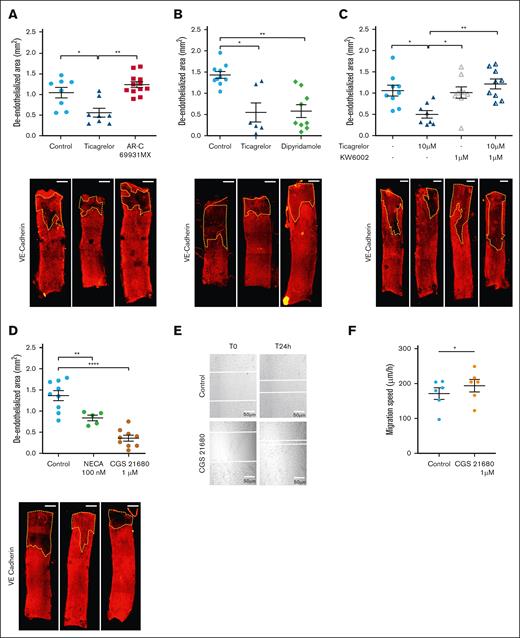 Ticagrelor-induced endothelial healing is dependent on adenosine and A2A receptor activation. (A) Quantification of deendothelialized area (upper panel) and representative confocal images of en face carotid arteries (lower panel) cultured ex vivo in control media, or in media containing ticagrelor (10 μM), or P2Y12 inhibitor AR-C69931MX (10 μM) and stained with anti–VE-cadherin. (B) Quantification of deendothelialized area (upper panel) and representative confocal images of en face carotid arteries (lower panel) cultured ex vivo in control media or in media containing ticagrelor (10 μM) or dipyridamole (10 μM) and stained with anti–VE-cadherin. (C) Quantification of deendothelialized area (upper panel) and representative confocal images of en face carotid arteries (lower panel) cultured ex vivo in control media or in media containing ticagrelor (10 μM) with or without KW6002 (1 μM) and stained with anti–VE-cadherin. (D) Quantification of deendothelialized area (upper panel) and representative confocal images of en face carotid arteries cultured ex vivo in control media or in media containing a nonselective adenosine receptor agonist, NECA, or an A2A receptor–specific agonist, CGS21680, and stained with anti–VE-cadherin. The zone outlined in yellow represents the area that has not been recovered with endothelial cells. Scale bar: 0.5 mm. (E) Bright-field microscopy images of scratch wound healing assay in arterial endothelial cells treated with vehicle or CGS21680 (1 mM) at the indicated times. The scratch edge is demarcated by the white dotted line (n = 6). Scale bar = 200 μm. (F) Quantification of migration speed of scratch wound healing assay in the indicated conditions. Data shown are means ± SEM. ∗P < .05. The statistical significance of differences between 2 groups was determined using the unpaired Student t test, and differences among multiple groups were determined using 1-way ANOVA followed by the Bonferroni post hoc test (intragroup comparisons). Values of P <.05 were considered statistically significant. ∗P < .05, ∗∗P < .01, ∗∗∗P < .001.