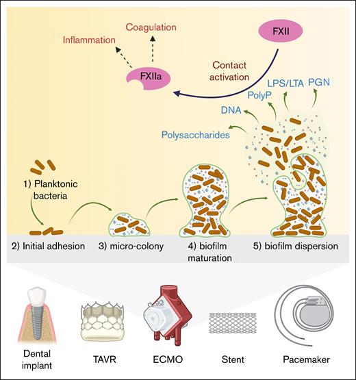 Biofilm formation on intravascular implants and devices and its role in coagulation and inflammation. The illustration shows how biofilms form on intravascular implants and devices, and how they can trigger blood clotting and inflammation. (1) Planktonic bacteria: planktonic bacteria move to the surface of the implant. (2) Initial adhesion: bacteria attach to the implant surface, starting the colonization process. (3) Microcolony formation: the attached bacteria start to grow and form small clusters, producing a protective slime. (4) Biofilm maturation: the biofilm develops into a structured, organized colony with a matrix composed of polysaccharides, extracellular DNA, LPS, or LTA, and PGN. (5) Biofilm dispersion: bacteria and matrix fragments are released from the biofilm, dispersing into the bloodstream and potentially inducing new infections. Released bacterial molecules, including LPS, LTA, and PGN, are capable of activating FXII, starting the blood clotting process. At the same time, bacterial fragments can trigger inflammation, creating a high-risk environment for thrombosis and immune reactions around the implant. ECMO, extracorporeal membrane oxygenation; PolyP, polyphosphates; TAVR, transcatheter aortic valve replacement.