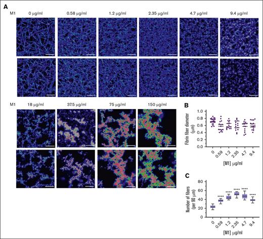 M1 protein affects fibrin clot architecture. (A) Representative LSCM images of plasma fibrin clots in the presence of rM1 protein (0-150 μg/mL) (n = 3). Clots were analyzed using a Leica TCS SP8X MP OPO spectral confocal microscope and images using 63× water immersion objective (pin hole: 1.0 airy, 16-bit resolution). (B) Fibers (n = 20) were selected at random per condition and quantified in terms of their diameters using ImageJ. (C) Fibrin fiber density was calculated from LSCM images by applying a grid overlay and counting the number of fibers crossing the lines (n = 3). Error bars represent standard error of the mean. (∗P < .05, ∗∗P < .01, ∗∗∗P < .001, ∗∗∗∗P < .0001, 1-way ANOVA with Dunnett post hoc test).