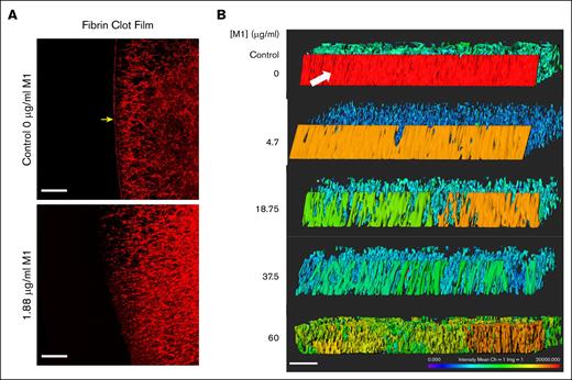 M1 protein impacts fibrin film formation. (A) LSCM of plasma fibrin film with and without the presence of rM1. Fibrin fibers were formed through the addition of thrombin in the presence or absence of 1.88 μg/mL rM1. Scale bar: 20 μm. n = 1. (B) LSCM of plasma fibrin film with increasing concentrations of rM1 (0-60 μg/mL). n = 3. Fibrinogen was fluorescently labelled with Alexa Fluor 594. Images were constructed in Imaris software. Scale bar: 20 μm. Fibrin film (arrow) forms a continuous layer on the surface of the clot, distinct from the fibrin fibers underneath.