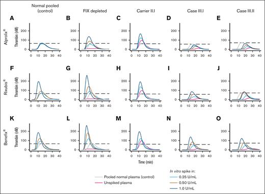 Evaluation of in vitro efficacy of recombinant FIX concentrates on thrombin generation in patient plasma. Thrombin-generation profiles on in vitro supplementation of Alprolix in (A) normal pooled plasma, (B) FIX-depleted plasma, (C) plasma of a hemophilia B carrier harboring p.(Gln96Arg), and (D-E) plasma of her 2 sons with hemophilia B. Thrombin-generation profiles on in vitro supplementation of Rixubis in (F) normal pooled plasma, (G) FIX-depleted plasma, (H) plasma of a hemophilia B carrier harboring p.(Gln96Arg), and (I-J) plasma of her 2 sons with hemophilia B. Thrombin-generation profiles on in vitro supplementation of Benefix in (K) normal pooled plasma, (L) FIX-depleted plasma, (M) plasma of a hemophilia B carrier harboring p.(Gln96Arg), and (N-O) plasma of her 2 sons with hemophilia B. Data were obtained by CAT assay with 1 pM TF for coagulation initiation. Dashed lines indicate the peak height in the control condition (pooled normal human plasma).