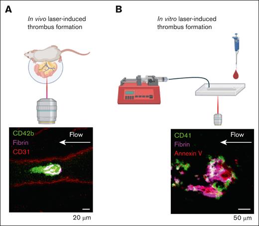 Ablation laser-injury models of thrombus formation. (A) In vivo laser-injury model performed by exteriorizing the mesenteric vein, or artery, and pulsing a high-powered laser. Representative image of platelet (CD42b, green) and fibrin (magenta) accumulation on mesenteric vein endothelium (CD31, red). (B) In vitro laser-injury model performed by pulsing a high-powered laser on the endothelialized surface of a microfluidic chip (Endo-chip). Representative image of platelet (CD41, green), fibrin (magenta), and annexin V (red).