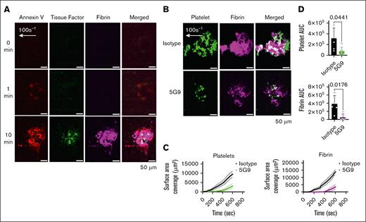 TF localizes to the endothelial injury site, and its inhibition reduces thrombus formation in the laser-injury Endo-chip. (A) Blood was labeled with annexin V-AF647, anti-TF antibody 5G9-Atto488 (2 μg/mL, detection dose), and anti-fibrin-594 antibody, recalcified with CaCl2 (10 mM), and then perfused through the Endo-chip at 100 s–1 followed by laser injury to the endothelial layer. Representative images of annexin V (red), TF (green), fibrin (magenta) at 0, 1, and 10 minutes after laser injury. (B) Blood was incubated with isotype control or inhibitory anti-TF antibody 5G9 (50 μg/mL, inhibitory dose) and then labeled with anti-CD41 antibody and antifibrin antibody, recalcified, and immediately perfused through the Endo-chip at 100 s–1 prior to laser injury. Representative images of platelet (CD41, green) and fibrin (magenta) accumulation at the injury site at 10 minutes. (C) Kinetics of platelet (left panel) and fibrin (right panel) surface area coverage over time in response to isotype control or 5G9. (D) Platelet (upper panel) and fibrin (lower panel) AUC after treatment of blood with isotype control or inhibitory anti-TF antibody 5G9. Mean ± SD, n = 6 independent experiments, paired t test. AUC, area under the curve.